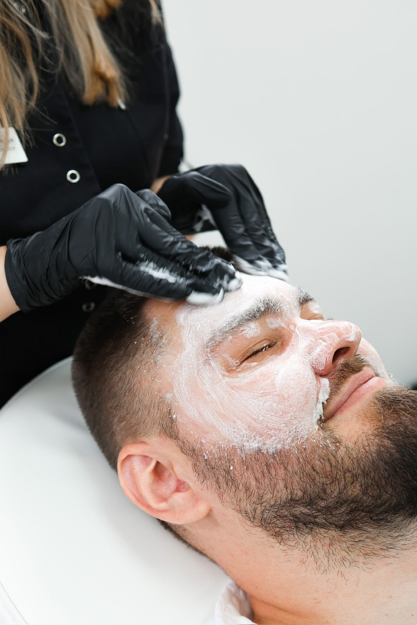 Obagi Blue Peel Radiance Peel for Hyperpigmented Skin in Kingston Upon Thames Surrey London