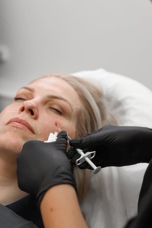 When Does Lip Filler Migrate